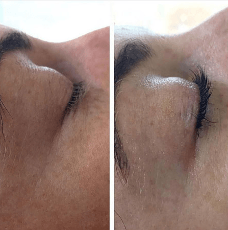 Before & After - Lash Lift & Tint