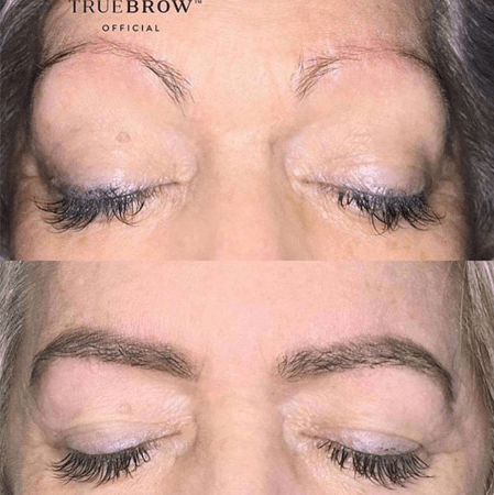 TRUEBROW - Before & After