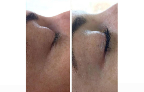 Before & After - Lash Lift & Tint 